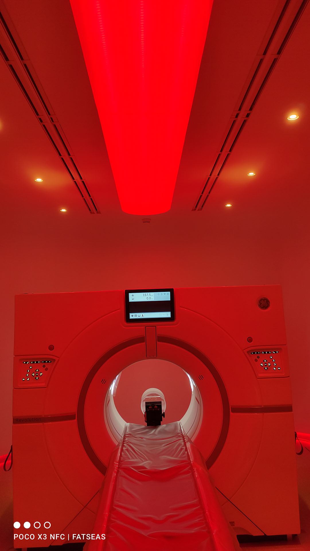 CT Scan Revolution